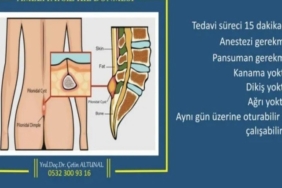 Kıl Dönmesi